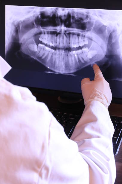 Best Emergency Dentist for Lost Fillings or Crowns in Erwin, NC
