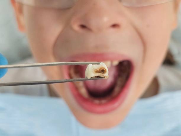 Best Mobile Emergency Dentist in Erwin, NC