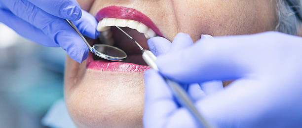 Best Emergency Root Canal Treatment in Erwin, NC